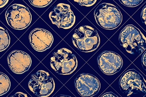 MRI scan, close-up