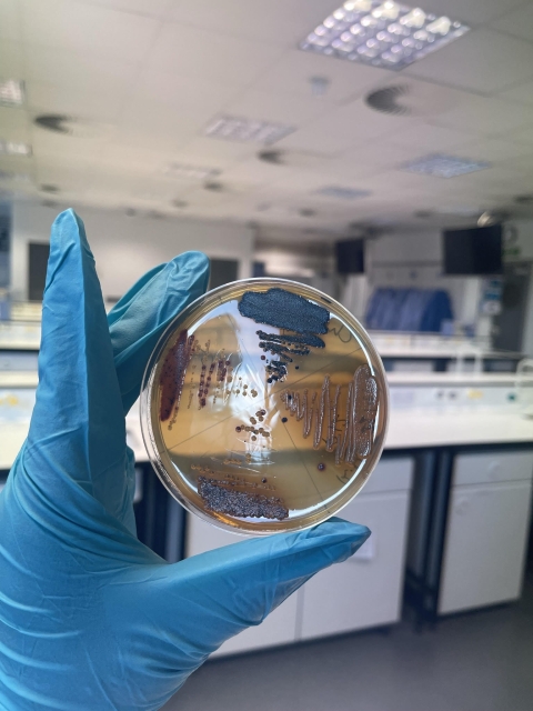 Performing microbiology experiments on patient samples. This shows the types of bacteria found in 4 patient samples after growing them on Chromogenic agar