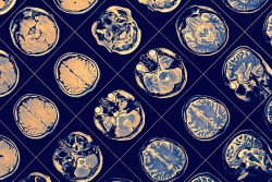 MRI scan, close-up